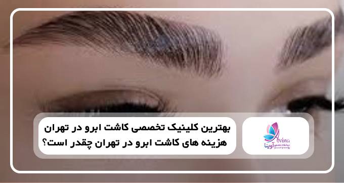 بهترین کلینیک تخصصی کاشت ابرو در تهران