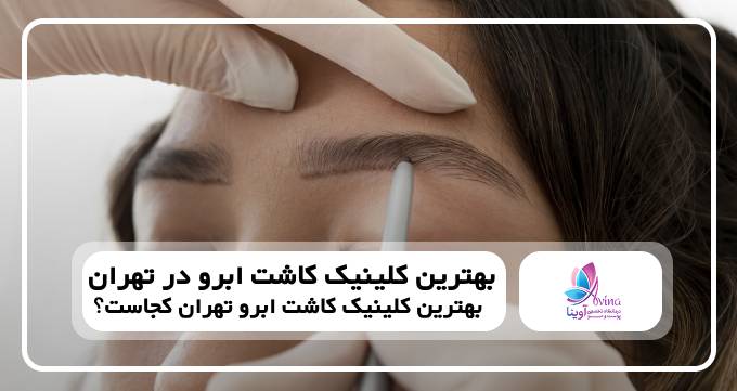 بهترین کلینیک کاشت ابرو در تهران