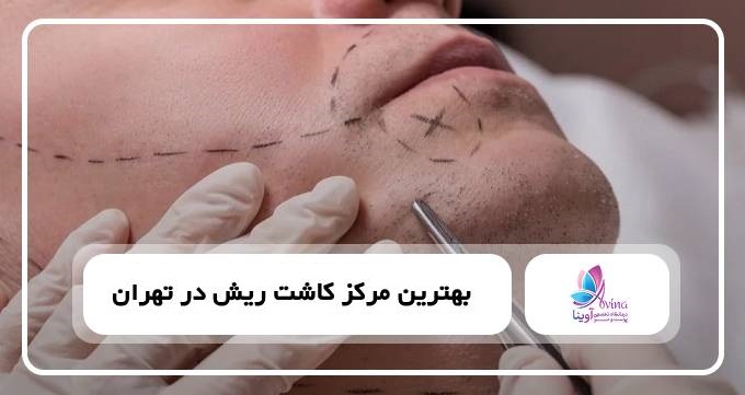 بهترین مرکز کاشت ریش در تهران