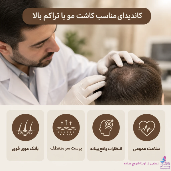 چه کسانی کاندیدای مناسب کاشت مو با تراکم بالا هستند؟