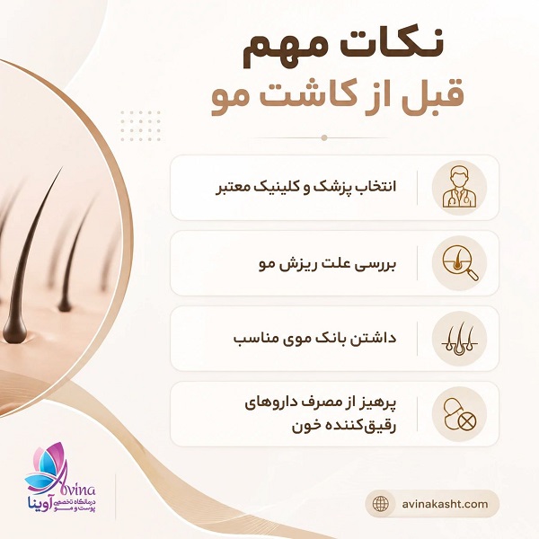 نکات مهم قبل از کاشت مو