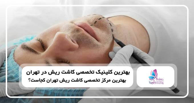 بهترین کلینیک تخصصی کاشت ریش در تهران