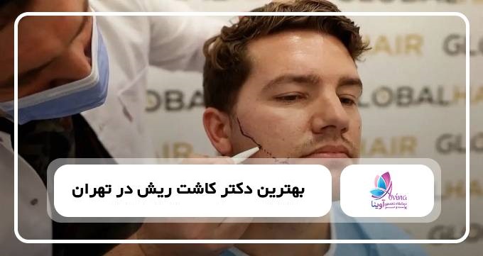 بهترین دکتر کاشت ریش در تهران
