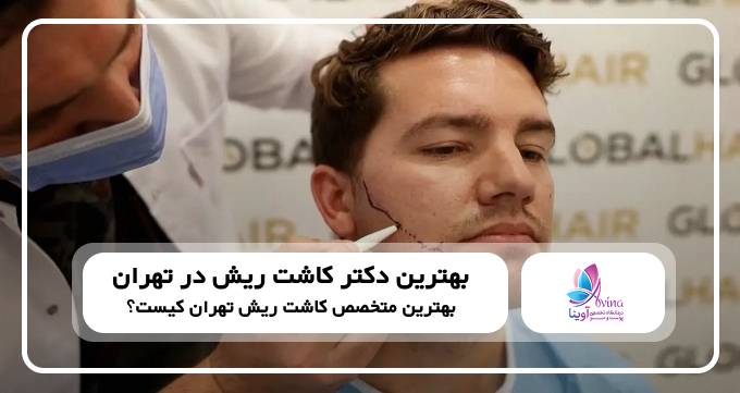 بهترین دکتر کاشت ریش در تهران