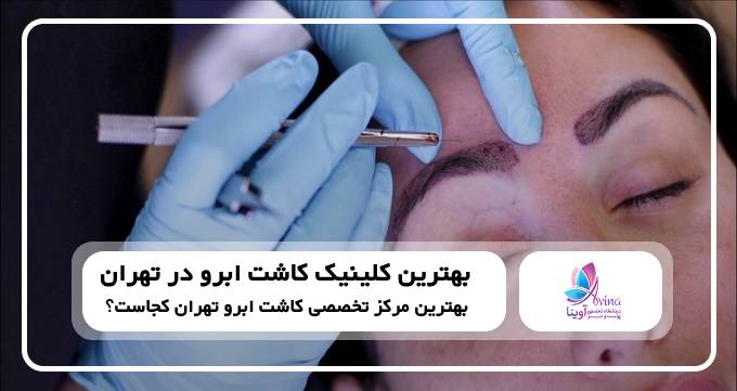 بهترین کلینیک کاشت ابرو در تهران