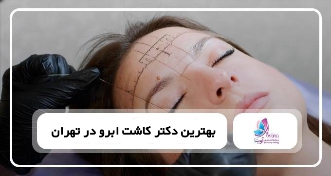 بهترین دکتر کاشت ابرو در تهران