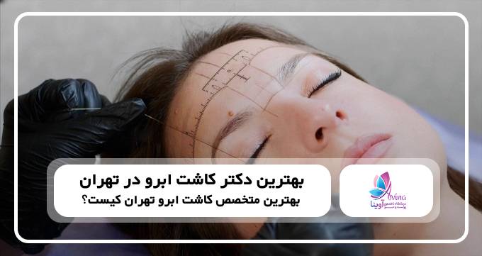 بهترین دکتر کاشت ابرو در تهران