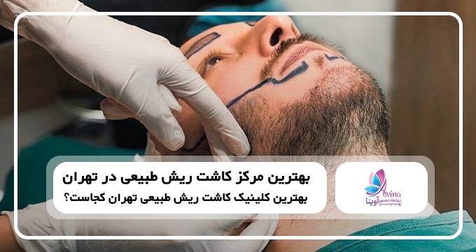 بهترین مرکز کاشت ریش طبیعی در تهران