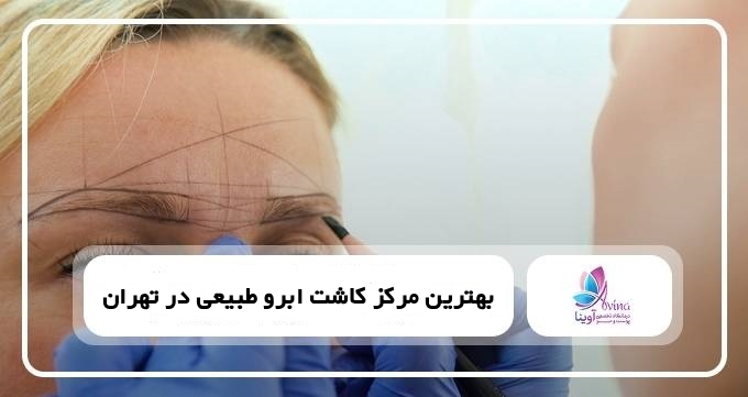 بهترین مرکز کاشت ابرو طبیعی در تهران【سال1405】