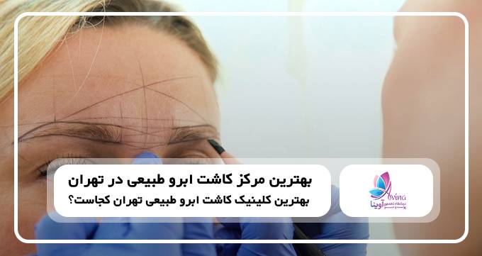 بهترین مرکز کاشت ابرو طبیعی در تهران