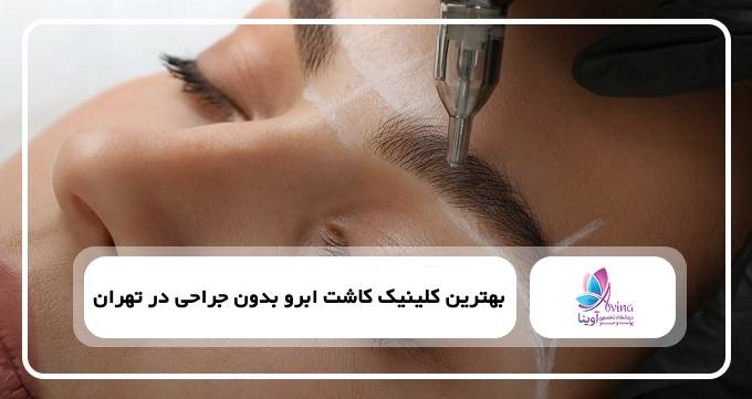 بهترین کلینیک کاشت ابرو بدون جراحی در تهران❤️【سال1405】✅