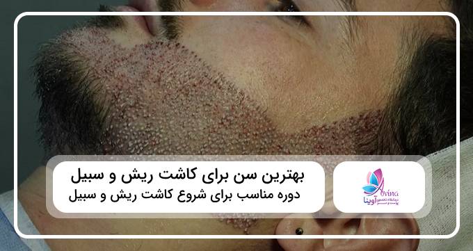 بهترین سن برای کاشت ریش و سبیل چه سنی است؟