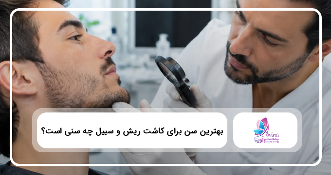 بهترین سن برای کاشت ریش و سبیل چه سنی است؟ ✅【سال۱۴۰۴】⚡