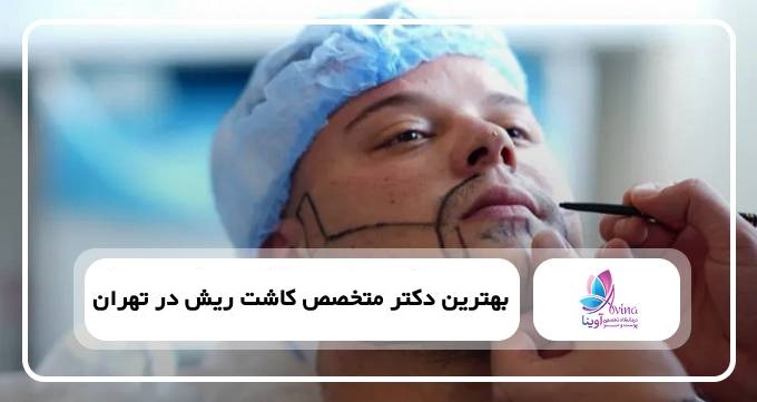 بهترین دکتر متخصص کاشت ریش در تهران