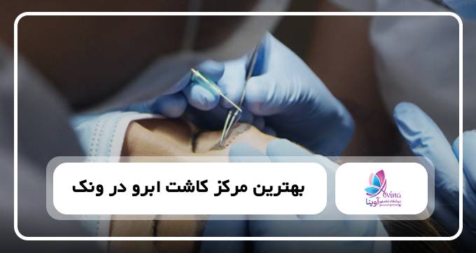 کاشت ابرو بدون جراحی microfit plus