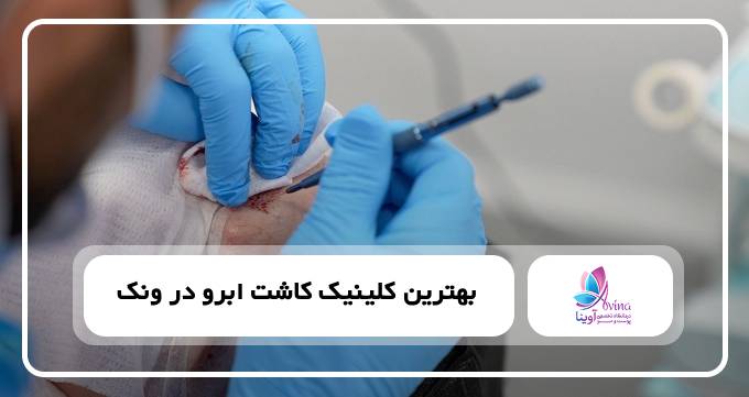 بهترین کلینیک کاشت ابرو در ونک