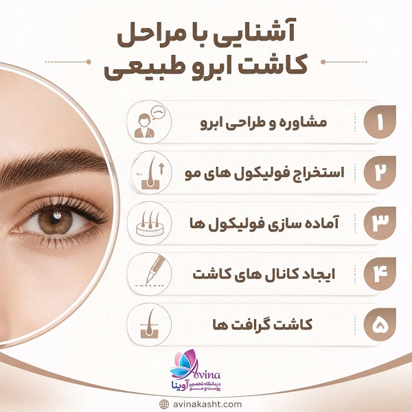 آشنایی با مراحل کاشت ابرو طبیعی