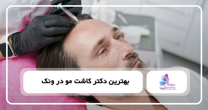 بهترین دکتر کاشت مو در ونک