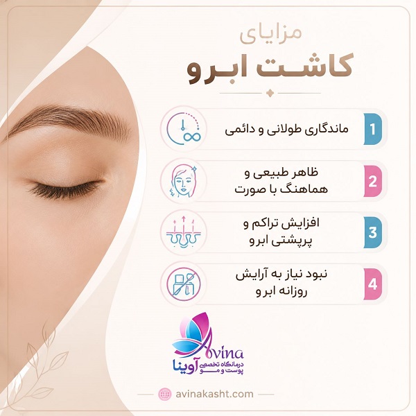 مزایای کاشت ابرو
