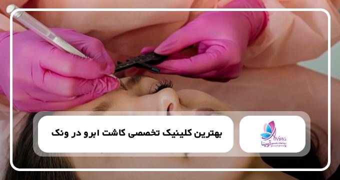 بهترین کلینیک کاشت ابرو