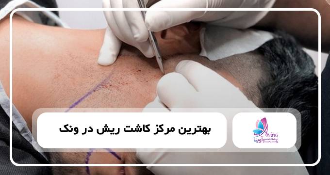 بهترین مرکز کاشت ریش در ونک