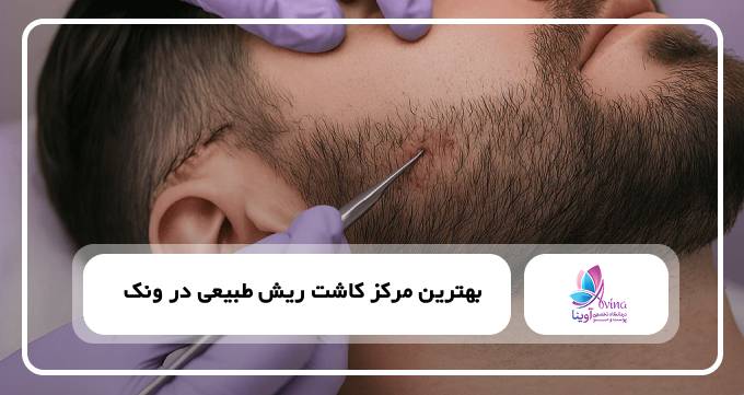 بهترین مرکز کاشت ریش طبیعی در ونک