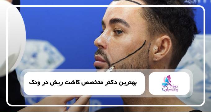بهترین دکتر متخصص کاشت ریش در ونک✅【سال۱۴۰۴】⚡