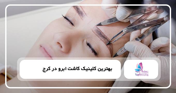 بهترین کلینیک کاشت ابرو در کرج
