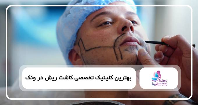 بهترین کلینیک تخصصی کاشت ریش در ونک