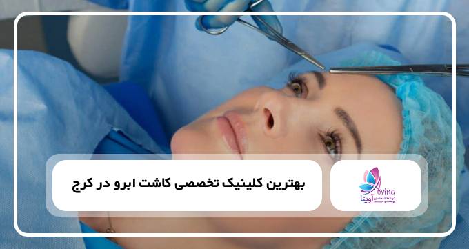 بهترین کلینیک تخصصی کاشت ابرو در کرج