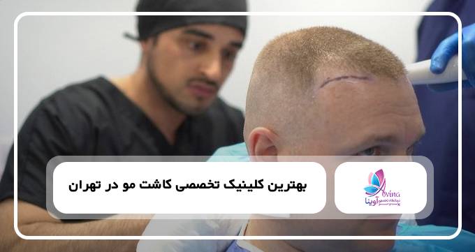 بهترین کلینیک تخصصی کاشت مو در تهران