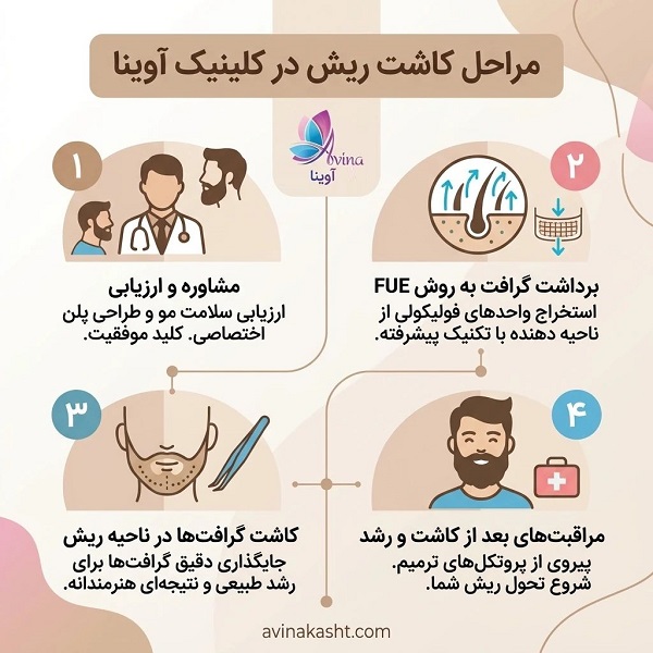 مراحل کاشت ریش در کلینیک آوینا