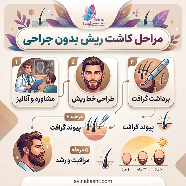 مراحل کاشت ریش بدون جراحی