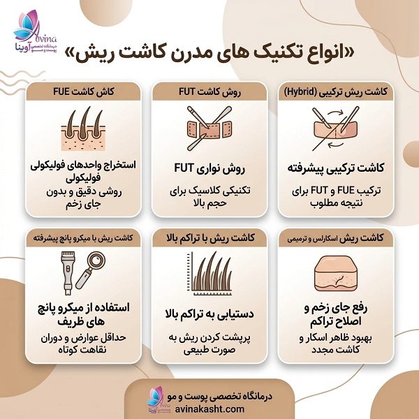 انواع تکنیک های مدرن کاشت ریش