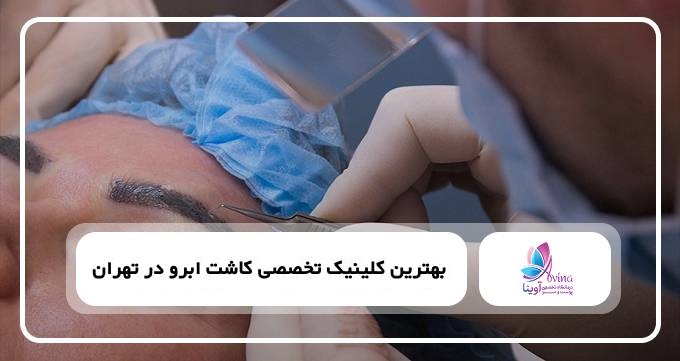 بهترین کلینیک تخصصی کاشت ابرو در تهران【سال1405】⭐