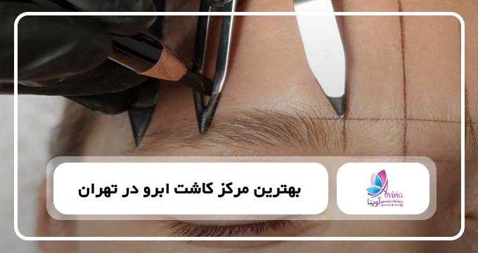 بهترین مرکز کاشت ابرو در تهران【سال1405】⚡