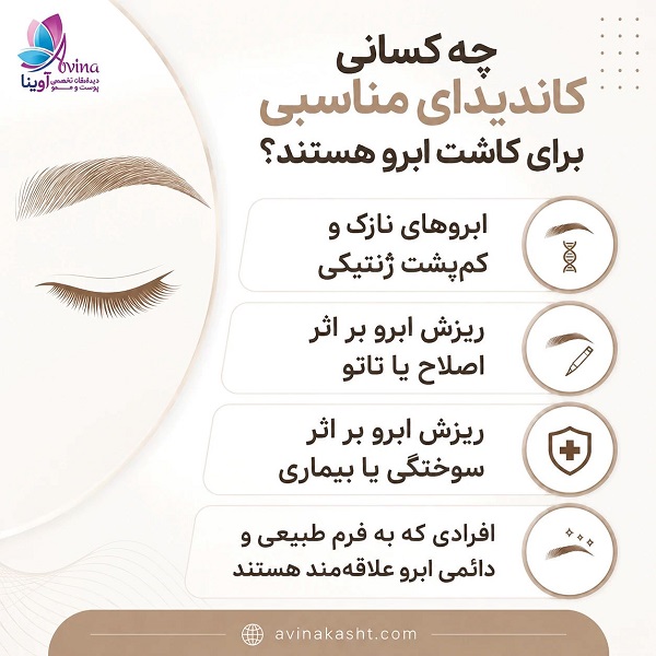 چه کسانی کاندیدای مناسبی برای کاشت ابرو هستند؟