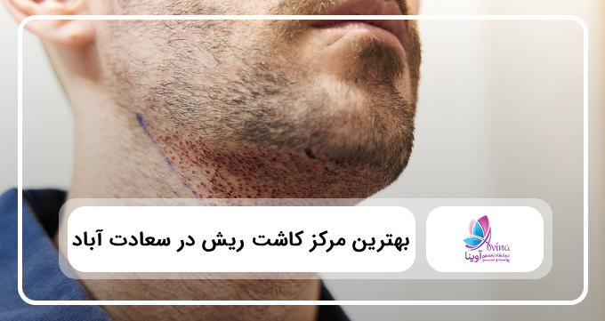 بهترین مرکز کاشت ریش در سعادت آباد