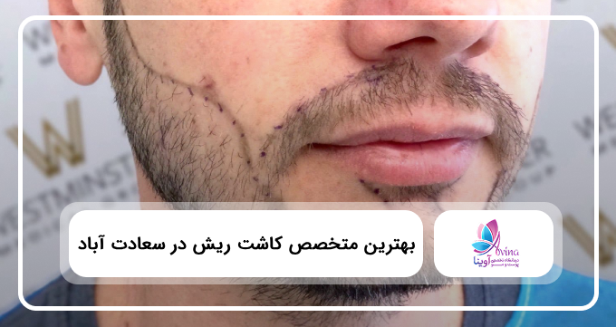 بهترین متخصص کاشت ریش در سعادت آباد