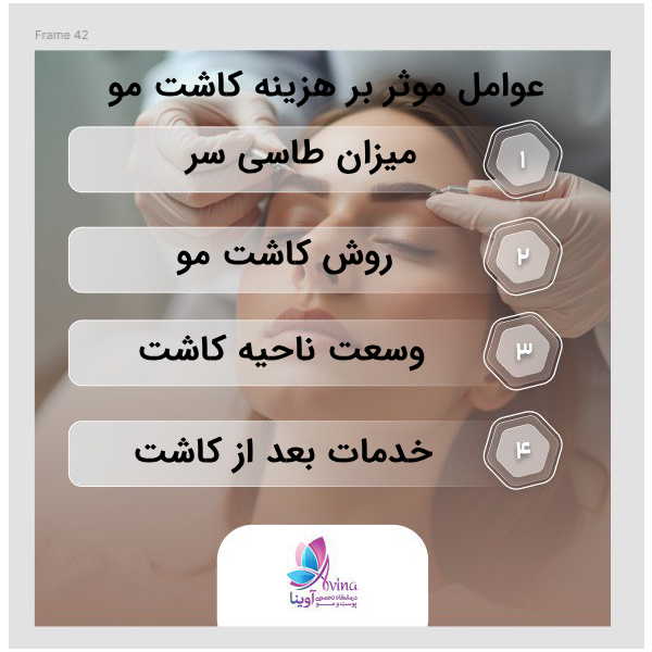 هزینه کاشت مو در ونک چقدر است؟